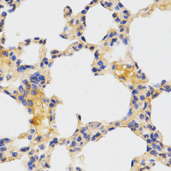 Immunofluorescence analysis of U2OS cells using TNRC6A Polyclonal Antibody at dilution of  1:100. Blue: DAPI for nuclear staining.