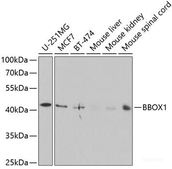 Immunohistochemistry of paraffin-embedded Rat brain using CRABP2 Polyclonal Antibody at dilution of  1:100 (40x lens).