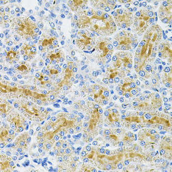 Immunofluorescence analysis of C6 cells using CSF2 Polyclonal Antibody at dilution of  1:100. Blue: DAPI for nuclear staining.