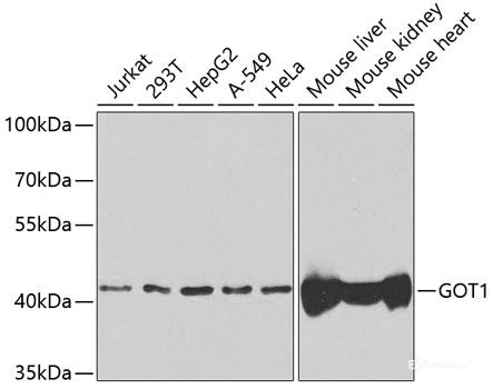 Immunohistochemistry of paraffin-embedded Mouse lung using ERBB4 Polyclonal Antibody at dilution of  1:100 (40x lens).