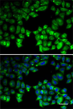 Immunohistochemistry of paraffin-embedded Rat ovary using KMT2E Polyclonal Antibody at dilution of  1:200 (40x lens).