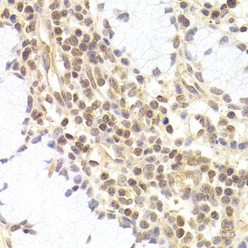 Immunohistochemistry of paraffin-embedded Human prostate using OSM Polyclonal Antibody at dilution of  1:100 (40x lens).