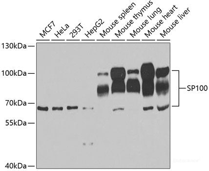 Western blot analysis of extracts of Jurkat cells using ANKRD1 Polyclonal Antibody at dilution of 1:1000.