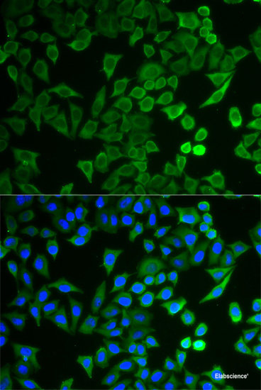 Immunohistochemistry of paraffin-embedded Human stomach using KCND2 Polyclonal Antibody at dilution of  1:100 (40x lens).