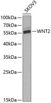 Immunofluorescence analysis of Human liver cancer using SERPINE1 Polyclonal Antibody at dilution of  1:100 (40x lens). Blue: DAPI for nuclear staining.
