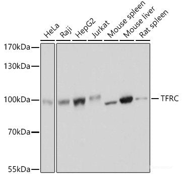 Immunohistochemistry of paraffin-embedded Mouse kidney using SET Polyclonal Antibody at dilution of  1:100 (40x lens).