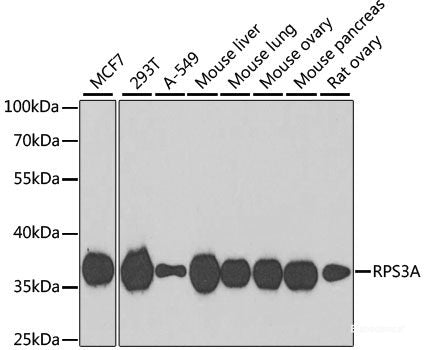 Immunofluorescence analysis of C6 cells using TADA3 Polyclonal Antibody at dilution of  1:100. Blue: DAPI for nuclear staining.