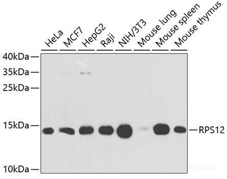 Immunohistochemistry of paraffin-embedded Mouse testis using FDFT1 Polyclonal Antibody at dilution of  1:100 (20x lens).