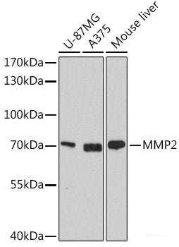 Immunohistochemistry of paraffin-embedded Rat ovary using COX5A Polyclonal Antibody at dilution of  1:100 (40x lens).