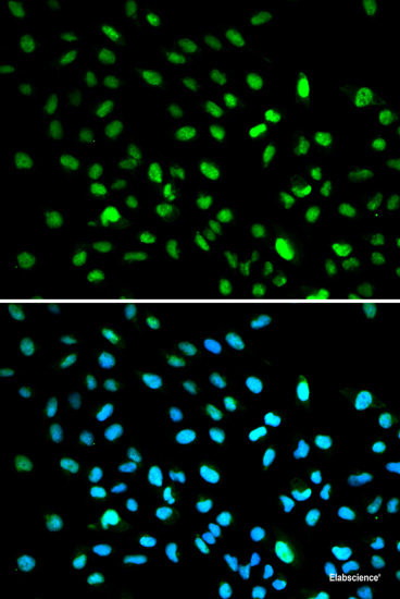 Immunohistochemistry of paraffin-embedded Human stomach using NHLRC1 Polyclonal Antibody at dilution of  1:100 (40x lens).