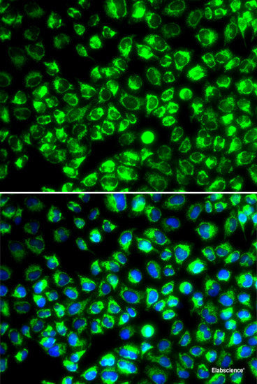 Immunohistochemistry of paraffin-embedded Rat heart using POLG2 Polyclonal Antibody at dilution of  1:100 (40x lens).