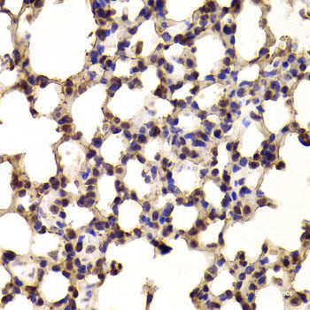 Immunohistochemistry of paraffin-embedded Mouse heart using PPP1R12A Polyclonal Antibody at dilution of  1:100 (40x lens).