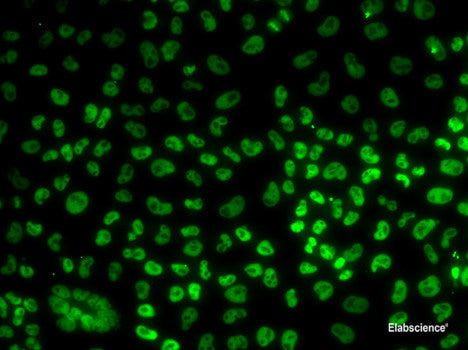Western blot analysis of extracts of various cell lines using PPP2CA Polyclonal Antibody at dilution of 1:1000.