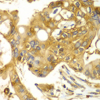 Immunohistochemistry of paraffin-embedded Mouse brain using PROK2 Polyclonal Antibody at dilution of  1:100 (40x lens).