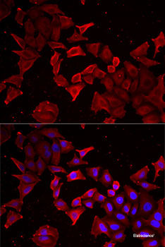 Immunohistochemistry of paraffin-embedded Human kidney using PSMD12 Polyclonal Antibody at dilution of  1:100 (40x lens).