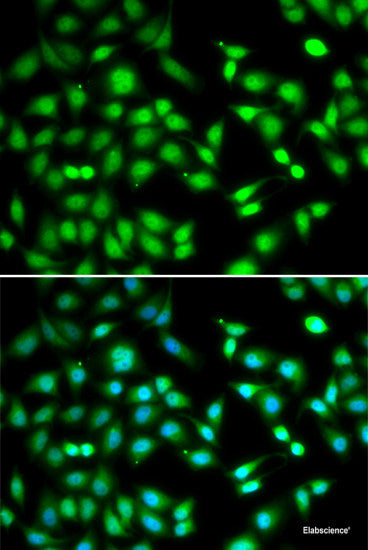 Immunofluorescence analysis of C6 cells using RECK Polyclonal Antibody at dilution of  1:100 (40x lens). Blue: DAPI for nuclear staining.
