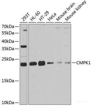 Immunohistochemistry of paraffin-embedded Human stomach using RPLP1 Polyclonal Antibody at dilution of  1:100 (40x lens).