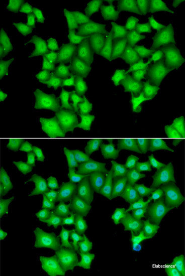 Immunohistochemistry of paraffin-embedded Human stomach using RPS2 Polyclonal Antibody at dilution of  1:100 (40x lens).