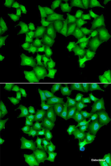 Immunohistochemistry of paraffin-embedded Human stomach using RPS2 Polyclonal Antibody at dilution of  1:100 (40x lens).
