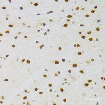 Immunohistochemistry of paraffin-embedded Rat brain using RPS7 Polyclonal Antibody at dilution of  1:100 (40x lens).