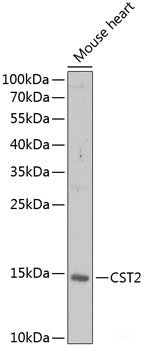 Immunohistochemistry of paraffin-embedded Human liver using SCO1 Polyclonal Antibody at dilution of  1:100 (40x lens).