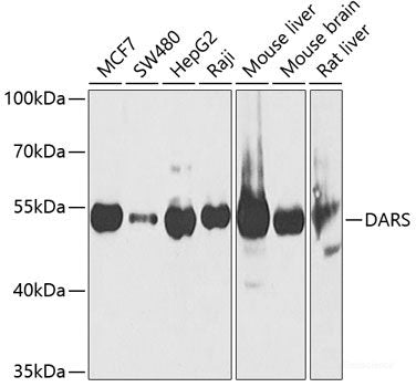 Immunohistochemistry of paraffin-embedded Human liver damage using SECISBP2 Polyclonal Antibody at dilution of  1:200 (40x lens).