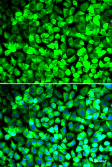 Immunohistochemistry of paraffin-embedded Rat ovary using SMPD1 / ASM Polyclonal Antibody at dilution of  1:100 (40x lens).