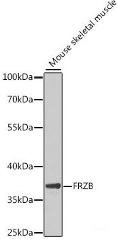 Immunohistochemistry of paraffin-embedded Human kidney using SPTLC1 Polyclonal Antibody at dilution of  1:100 (40x lens).