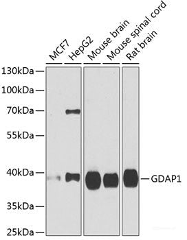 Immunohistochemistry of paraffin-embedded Mouse lung using STRN3 Polyclonal Antibody at dilution of  1:100 (40x lens).