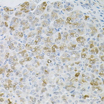 Immunohistochemistry of paraffin-embedded Rat kidney using TMED10 Polyclonal Antibody at dilution of  1:100 (40x lens).