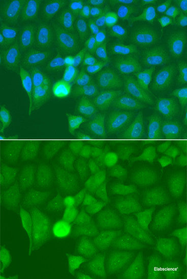Immunofluorescence analysis of HeLa cells using USP15 Polyclonal Antibody at dilution of  1:100 (40x lens). Blue: DAPI for nuclear staining.