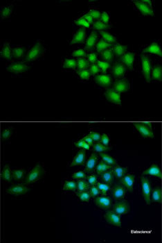 Immunohistochemistry of paraffin-embedded Rat liver using CPT1B Polyclonal Antibody at dilution of  1:100 (40x lens).