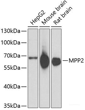 Immunohistochemistry of paraffin-embedded Rat brain using MUS81 Polyclonal Antibody at dilution of  1:100 (40x lens).