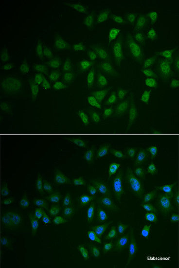 Immunohistochemistry of paraffin-embedded Rat liver using WDR48 Polyclonal Antibody at dilution of  1:100 (40x lens).