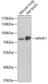 Immunohistochemistry of paraffin-embedded Human liver damage using ASGR1 Polyclonal Antibody at dilution of  1:100 (40x lens).