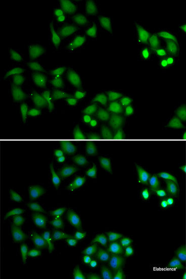Immunofluorescence analysis of HeLa cells using ASPH Polyclonal Antibody 