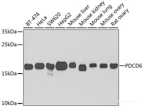 Immunohistochemistry of paraffin-embedded Rat kidney using C1S Polyclonal Antibody at dilution of  1:200 (40x lens).