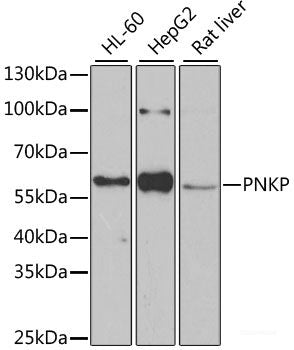 Immunofluorescence analysis of HeLa cells using CTNS Polyclonal Antibody 
