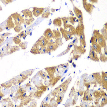 Immunohistochemistry of paraffin-embedded Mouse brain using DGUOK Polyclonal Antibody at dilution of  1:100 (40x lens).