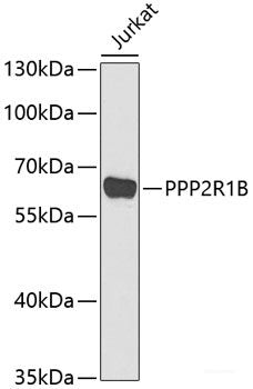 Immunohistochemistry of paraffin-embedded Rat kidney using ENPEP Polyclonal Antibody at dilution of  1:200 (40x lens).