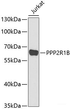 Immunohistochemistry of paraffin-embedded Rat kidney using ENPEP Polyclonal Antibody at dilution of  1:200 (40x lens).