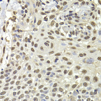 Immunohistochemistry of paraffin-embedded Rat brain using GALNT2 Polyclonal Antibody at dilution of  1:100 (40x lens).