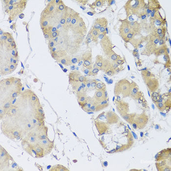 Immunohistochemistry of paraffin-embedded Rat intestine using HPGD Polyclonal Antibody at dilution of  1:100 (40x lens).