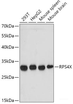 Immunohistochemistry of paraffin-embedded Rat brain using MYH1 Polyclonal Antibody at dilution of  1:100 (40x lens).