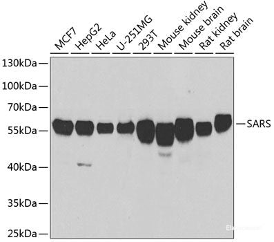 Immunohistochemistry of paraffin-embedded Rat brain using HNRNPM Polyclonal Antibody at dilution of  1:100 (40x lens).