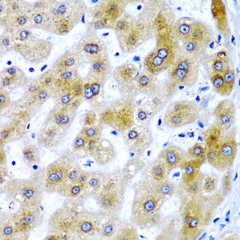 Immunohistochemistry of paraffin-embedded Rat retina using PDE6B Polyclonal Antibody at dilution of  1:200 (40x lens).