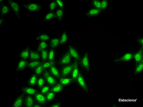 Immunohistochemistry of paraffin-embedded Rat ovary using PFKFB3 Polyclonal Antibody at dilution of  1:100 (40x lens).