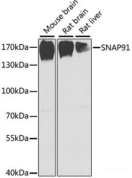 Immunohistochemistry of paraffin-embedded Rat kidney using PRKAB2 Polyclonal Antibody at dilution of  1:100 (40x lens).