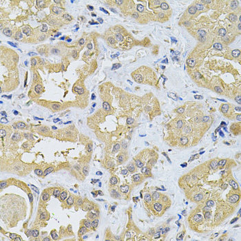 Immunohistochemistry of paraffin-embedded Rat kidney using PSMD5 Polyclonal Antibody at dilution of  1:100 (40x lens).