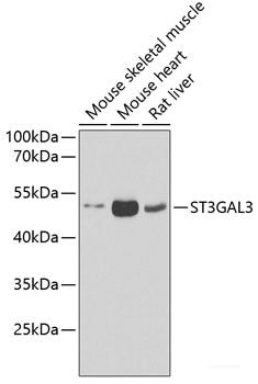 Immunohistochemistry of paraffin-embedded Human prostate using RAD51C Polyclonal Antibody at dilution of  1:100 (40x lens).
